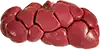 Riñones rojos
